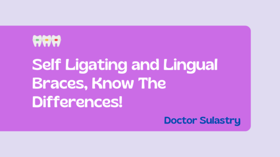 Self Ligating and Lingual Braces, Know The Differences!